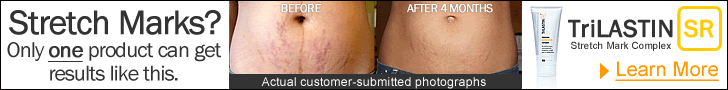 Trilastin Before and After Pictures